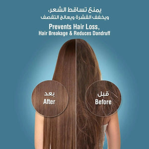 blu Ionic Shower Filter - Skin & Haircare - Removes Chlorine & Harmful Pollutants - Prevents Hair Loss & Moisturize your Skin - Handheld - Chrome